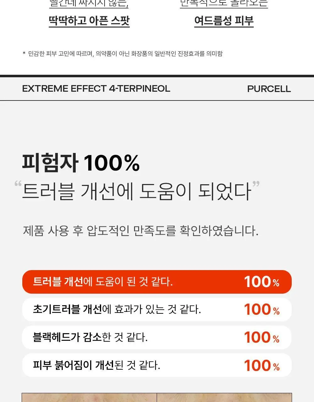[트러블케어/스팟진정] 퍼셀 익스트림 이펙트 터피네올 원액 10ml 상세페이지 4
